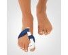 Hallux Valgus