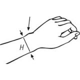 Bort Handgelenksttze